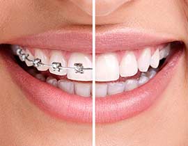 SE Calgary Orthodontic Dentistry | Copperstone Dental