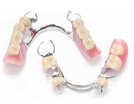 Calgary Partial Dentures