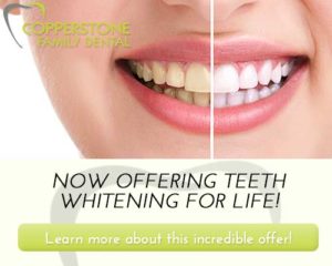 Copperstone Dental | Teeth Whitening For Life