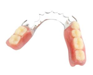 Partial Dentures | Copperstone Dental | Calgary Dentures